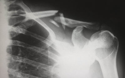 Orthopedic Urgent Care: Common Injuries